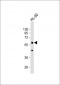 POLG2 Antibody (Center)